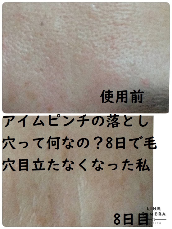 アイムピンチ使用前後